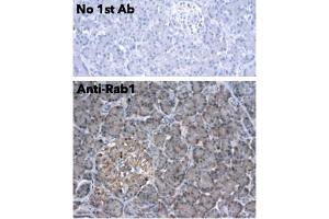 Immunohistochemistry (IHC) image for anti-RAB1A, Member RAS Oncogene Family (RAB1A) (C-Term) antibody (ABIN1440053)