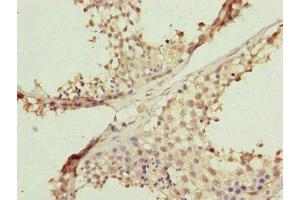 Immunohistochemistry of paraffin-embedded human testis tissue using ABIN7152484 at dilution of 1:100 (FBXL5 anticorps  (AA 1-310))