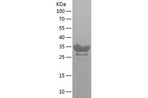 Western Blotting (WB) image for Immunoglobulin J Polypeptide, Linker Protein For Immunoglobulin alpha and mu Polypeptides (IGJ) (AA 40-89) protein (His-IF2DI Tag) (ABIN7123406)
