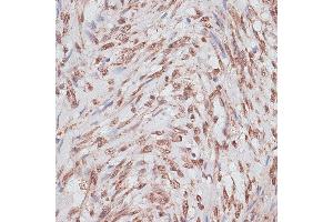 Immunohistochemistry of paraffin-embedded human uterus using RP/RP/RP antibody (ABIN6128653, ABIN6147083, ABIN6147084 and ABIN6214011) at dilution of 1:100 (40x lens).