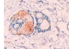 Detection of CA12 in Rat Skin Tissue using Polyclonal Antibody to Carbonic Anhydrase XII (CA12)