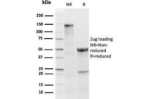 SDS-PAGE Analysis Purified TPO Recombinant Rabbit Monoclonal Antibody (TPO/3813R). (Recombinant TPO (AA 685-804) anticorps)