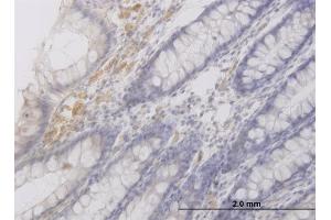 Immunoperoxidase of monoclonal antibody to RAB42 on formalin-fixed paraffin-embedded human colon. (RAB42 anticorps  (AA 46-105))