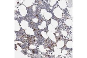 Immunohistochemical staining of human bone marrow with FBXO43 polyclonal antibody  shows strong cytoplasmic positivity in subsets of bone marrow poietic cells. (FBXO43 anticorps)