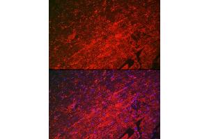Immunofluorescence analysis of mouse heart using HSPB8/HSP22 Rabbit pAb (ABIN3016166, ABIN3016167, ABIN3016168 and ABIN6219596) at dilution of 1:100 (40x lens).