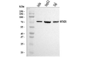 Western blot analysis of MT-ND5 using anti-MT-ND5 antibody (ABIN7600145). (MT-ND5 anticorps  (AA 154-570))