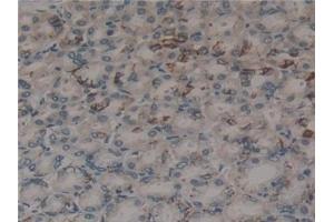 Detection of MFAP2 in Rat Stomach Tissue using Polyclonal Antibody to Microfibrillar Associated Protein 2 (MFAP2)