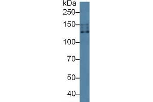 Detection of NCCT in Human 293T cell lysate using Polyclonal Antibody to Na-Cl Cotransporter (NCCT)