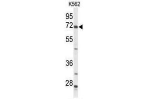 Western blot analysis of ACSS2 Antibody (N-term) in K562 cell line lysates (35 µg/lane). (ACSS2 anticorps  (N-Term))