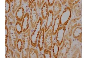 IHC image of ABIN7154884 diluted at 1:220 and staining in paraffin-embedded human kidney tissue performed on a Leica BondTM system.