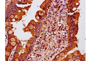 IHC image of ABIN7159553 diluted at 1:400 and staining in paraffin-embedded human small intestine tissue performed on a Leica BondTM system.