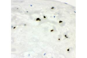 IHC analysis of CCNE1 using anti-CCNE1 antibody (ABIN7601193). (Cyclin E1 anticorps  (AA 3-386))