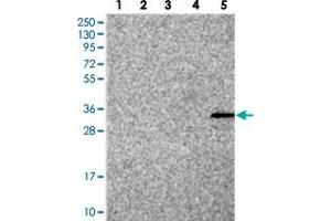 Western blot analysis of Lane 1: RT-4, Lane 2: U-251 MG, Lane 3: Human Plasma, Lane 4: Liver, Lane 5: Tonsil with FAM70B polyclonal antibody . (TMEM255B anticorps)