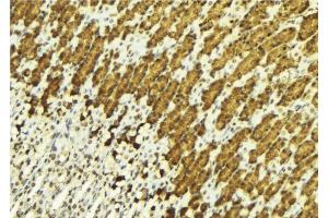 ABIN6269054 at 1/100 staining Human gastric tissue by IHC-P.
