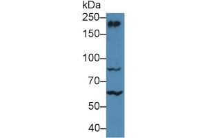 Western Blot; Sample: Mouse Cerebrum lysate; Primary Ab: 5µg/ml Rabbit Anti-Human MYH10 Antibody Second Ab: 0. (MYH10 anticorps  (AA 438-716))