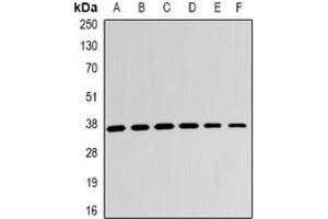Western blot analysis of LDHB expression in A431 (A), Jurkat (B), A549 (C), mouse kidney (D), mouse lung (E), rat brain (F) whole cell lysates. (LDHB anticorps)