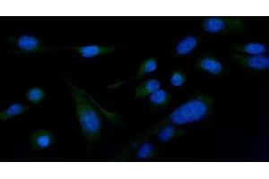 IF analysis of PLCG 2/PLCG2 using anti-PLCG 2/PLCG2 antibody (ABIN5692854). (Phospholipase C gamma 2 anticorps  (AA 1201-1258))