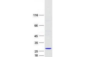 Validation with Western Blot