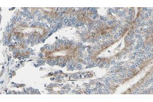 ABIN6268879 at 1/100 staining Human prostate tissue by IHC-P. (Actin anticorps  (N-Term))