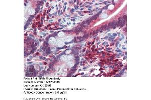 Immunohistochemistry with Human Small Intestine tissue at an antibody concentration of 5. (TRIM35 anticorps  (Middle Region))