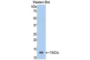 WB of Protein Standard: different control antibodies against Highly purified E. (Vitamin D-Binding Protein Kit ELISA)