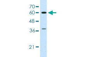 Western blot analysis of Jurkat cell lysate with HNRNPL polyclonal antibody . (HNRNPL anticorps  (AA 82-131))