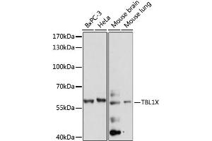 Western blot analysis of extracts of various cell lines, using TBL1X antibody. (TBL1X anticorps)