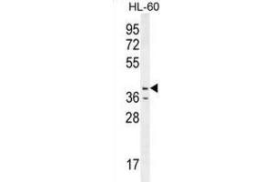 Western Blotting (WB) image for anti-Caspase 12 (Gene/pseudogene) (CASP12) antibody (ABIN2996496) (Caspase 12 anticorps)