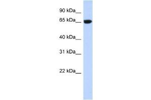 GTPBP2 antibody used at 1 ug/ml to detect target protein. (GTPBP2 anticorps  (N-Term))