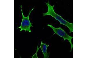 Immunofluorescence analysis of LOVO cells using Rab10 mouse mAb (green). (RAB10 anticorps)