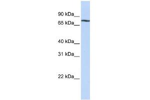 WB Suggested Anti-MYBL1 Antibody Titration:  0. (MYBL1 anticorps  (C-Term))