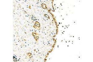 Immunohistochemistry of paraffin embedded mouse skin using hmgn1 (ABIN7074222) at dilution of 1: 1800 (200x lens)