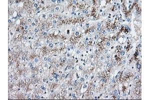 Immunohistochemical staining of paraffin-embedded Human liver tissue using anti-EIF2S1 mouse monoclonal antibody. (EIF2S1 anticorps)