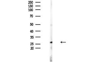 anti-N-Acetyltransferase 14 (GCN5-Related, Putative) (NAT14) (C-Term) antibody