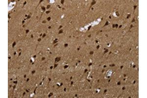 The image on the left is immunohistochemistry of paraffin-embedded Human brain tissue using ABIN7189815(ANP32E Antibody) at dilution 1/20, on the right is treated with synthetic peptide. (ANP32E anticorps)