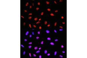 Immunofluorescence analysis of U-2 OS cells using P Rabbit mAb (ABIN7269445) at dilution of 1:100 (40x lens). (PABPN1 anticorps)