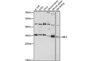 Western blot analysis of extracts of various cell lines, using BIN3 antibody (ABIN7265931) at 1:1000 dilution. (BIN3 anticorps  (AA 1-253))