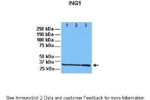 Lanes:   1: 30ug HeLa lysate, 2: 30ug HFF lysate, 3: 30ug U2OS lysate  Primary Antibody Dilution:   1:1000  Secondary Antibody:   Anti-rabbit HRP  Secondary Antibody Dilution:   1:5000  Gene Name:   ING1  Submitted by:   Dr.