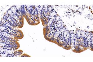 Detection of CK5 in Rat Colon Tissue using Polyclonal Antibody to Cytokeratin 5 (CK5)