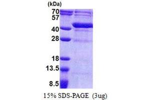 SDS-PAGE (SDS) image for Uracil phosphoribosyltransferase (FUR1) Homolog (UPRT) (AA 1-309) protein (His tag) (ABIN5853216) (UPRT Protein (AA 1-309) (His tag))