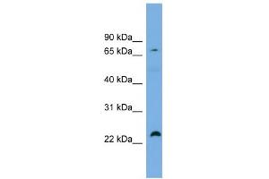 WB Suggested Anti-SPG20 Antibody Titration: 0. (SPG20 anticorps  (Middle Region))