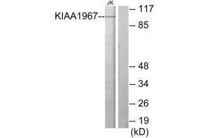 Western blot analysis of extracts from Jurkat cells, using KIAA1967 antibody. (CCAR2 anticorps)
