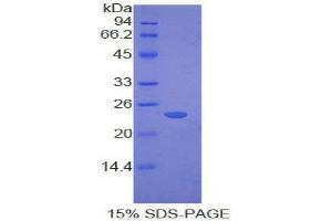 SDS-PAGE (SDS) image for Cathepsin G (CTSG) (AA 51-250) protein (His tag) (ABIN1877744)