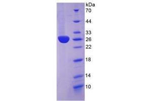 SDS-PAGE analysis of Rabbit C-Reactive Protein. (CRP Protéine)