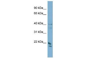 DYDC1 antibody used at 1 ug/ml to detect target protein. (DYDC1 anticorps  (Middle Region))