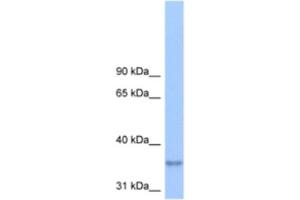 Western Blotting (WB) image for anti-Lipid Phosphate Phosphatase-Related Protein Type 2 (LPPR2) antibody (ABIN2463290) (LPPR2 anticorps)