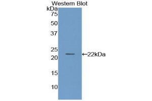 WB of Protein Standard: different control antibodies against Highly purified E.