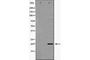 Western blot analysis of Interleukin 20 expression in A549 cells,The lane on the left is treated with the antigen-specific peptide. (IL-20 anticorps  (Internal Region))