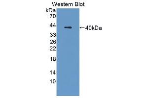Western blot analysis of the recombinant protein. (Cathepsin L anticorps  (AA 18-113))