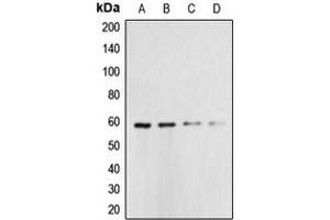 Western blot analysis of Caspase 10 expression in HeLa (A), Jurkat (B), A431 (C), K562 (D) whole cell lysates. (Caspase 10 anticorps  (Center))